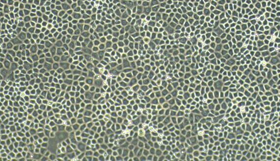 Primary Rat Pericardial Mesothelial Cells (PeMC)