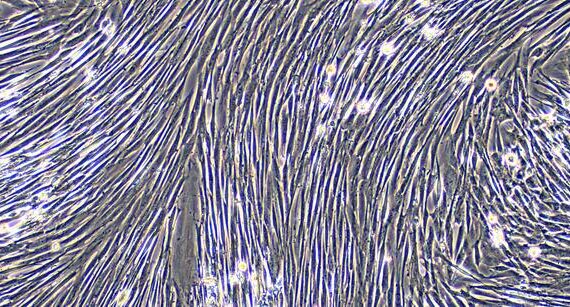 Primary Canine Vaginal Smooth Muscle Cells (VSMC)
