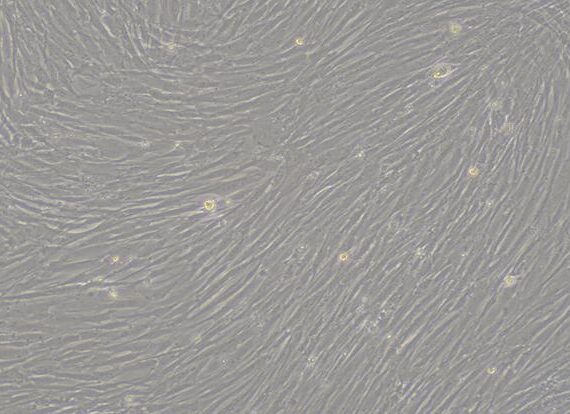 Primary Rabbit Vaginal Smooth Muscle Cells (VSMC)