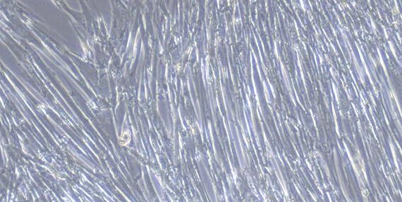 Primary Canine Inferior Vena Cava Smooth Muscle Cells (IVCSMC)