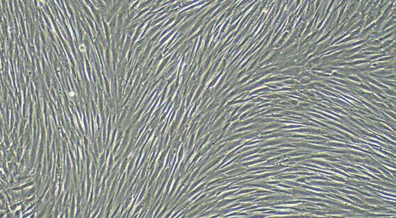 Primary Canine Endocardial Fibroblasts (EnCF)