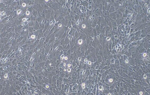 Primary Caprine Endocardial Fibroblasts (EnCF)