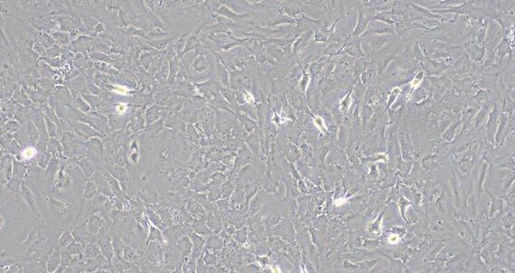 Primary Rat Endocardial Fibroblasts (EnCF)