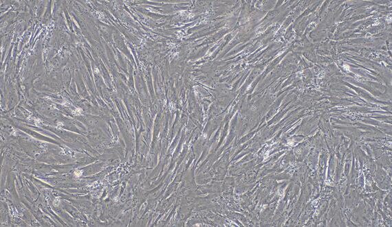 Primary Rabbit Endocardial Fibroblasts (EnCF)
