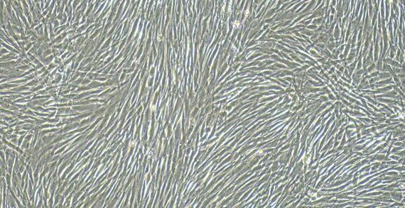 Primary Canine Epicardial Fibroblasts (EpCF)