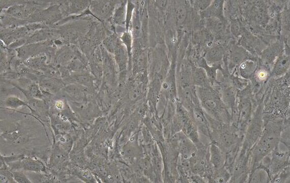 Primary Rabbit Epicardial Fibroblasts (EpCF)