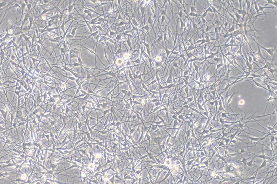 Primary Rat Dorsal Root Ganglion Neuron Cells (DRGN)