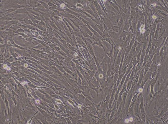 Primary Mouse Aorta Adventitial Fibroblasts (AAF)