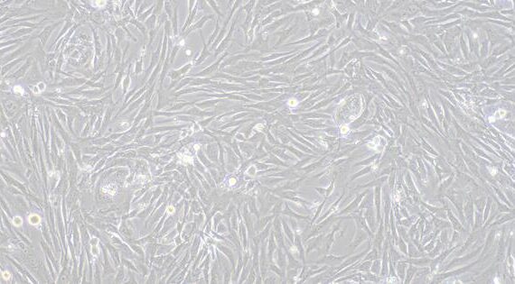 Primary Rabbit Seminal Vesicle Smooth Muscle Cells (SVSMC)
