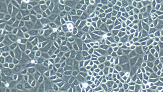 Primary Rat Pleural Mesothelial Cells (PlMC)