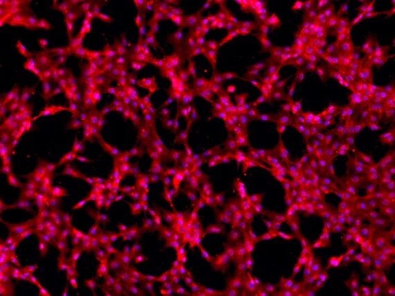 Primary Rat Periosteal Stem Cells (PeSC)