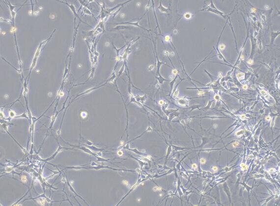 Primary Rabbit Olfactory Bulb Neuron Cells (OBNC)