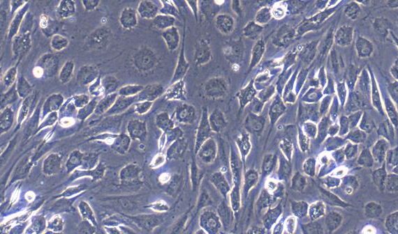 Primary Canine Peripheral Sciatic Nerve Fibroblasts (PSNC)