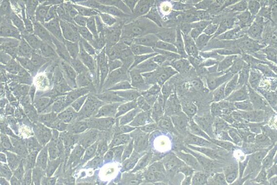 Primary Rabbit Lingual Muscle Skeletal Muscle Cells