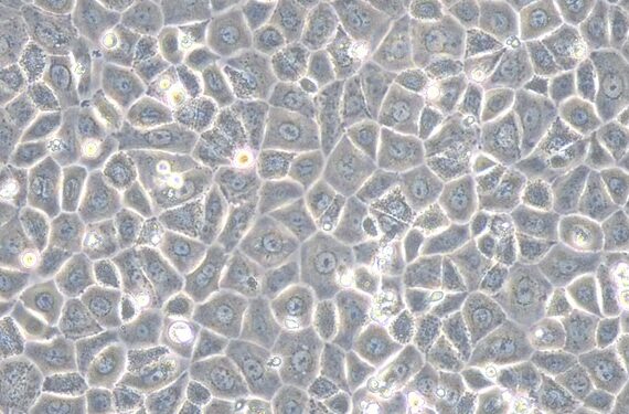 Primary Rat Lingual Epidermal Cells?LiEC?