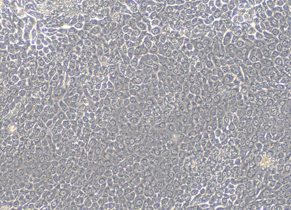 Primary Rat Placental subtotipotent Stem cells (PSSC)