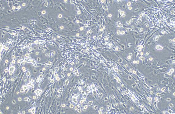Primary Rat Spinal Cord Perineurial Fibroblasts (SCPF)