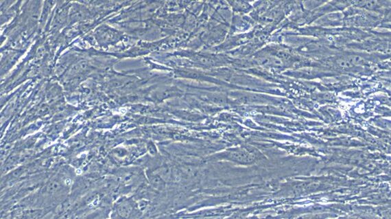 Primary Mouse Colonic Smooth Muscle Cells (CSMC)