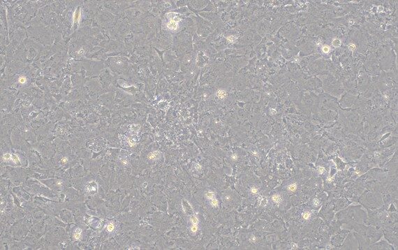 Primary Gallus Embryonic cardiomyocytes (ECMC)