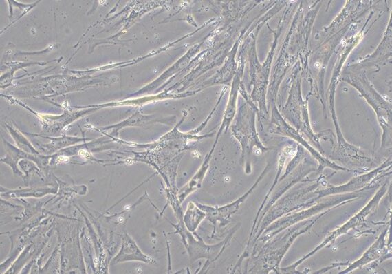 Primary Human Hepatic Stellate Cells (HSC)