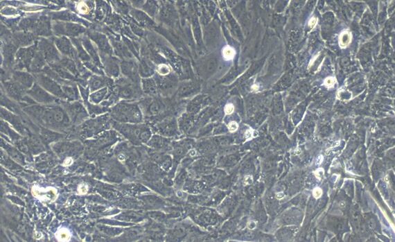 Primary Mouse Tendon Cells (TC)