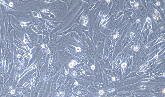 Primary Gullas Fetal Dermal Fibroblasts (FDF)