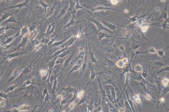 Primary Mouse Dorsal Root Ganglion Neuron Cells (DRGN)