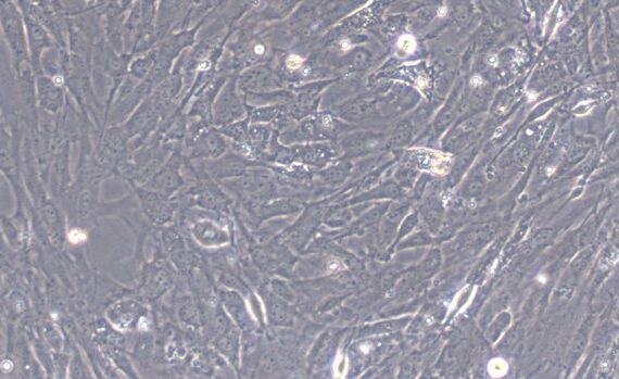 Primary Mouse Parotid Gland Cells (PGC)
