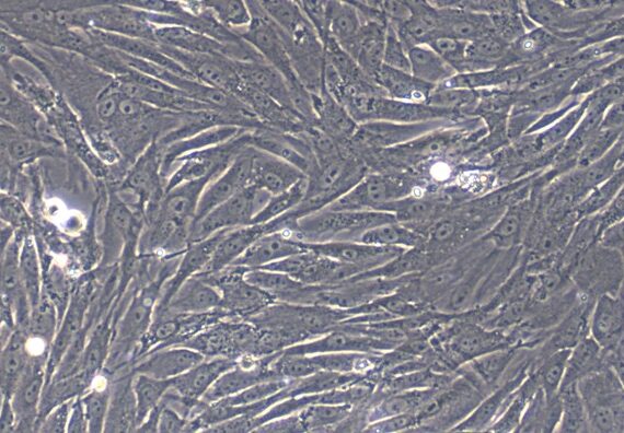Primary Rabbit Conjunctival Fibroblasts (CJVF)