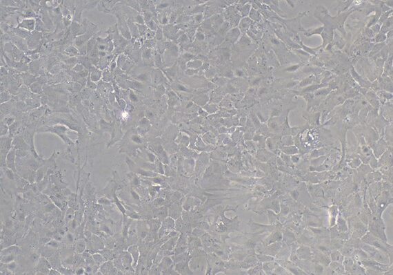 Primary Mouse Choroid Plexus Epithelial Cells (CPEC)