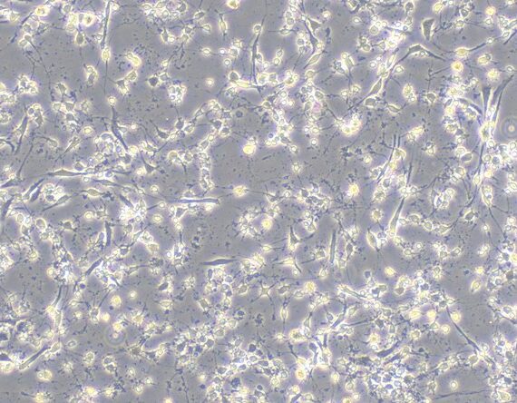 Primary Rat Cerebral Cortex Neuron Cells (CCNC)