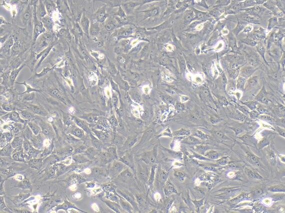 Primary Rat Skeletal Muscle Myoblasts (SMM)