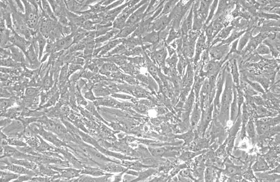 Primary Rabbit Intestinal Fibroblasts (IF)