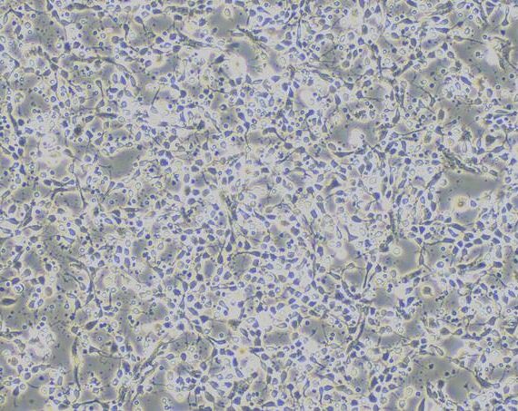Primary Mouse Hippocampal Neuron Cells (HNC)