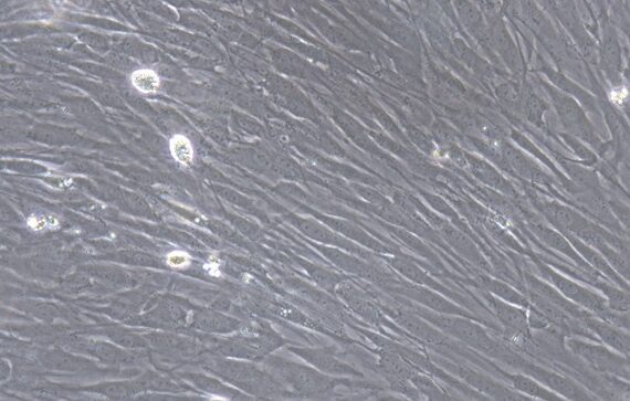 Primary Mouse Conjunctival Fibroblasts (CJVF)