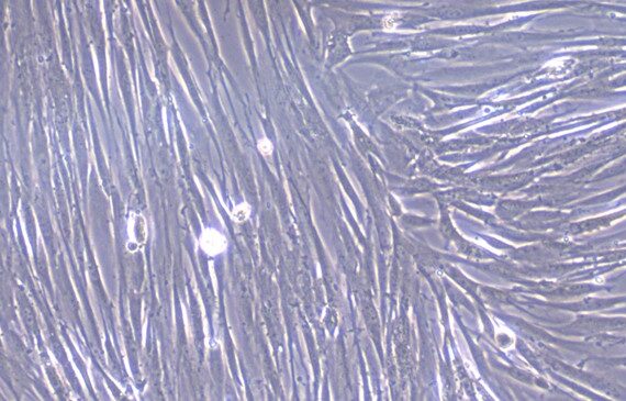 Primary Canine Conjunctival Fibroblasts (CJVF)
