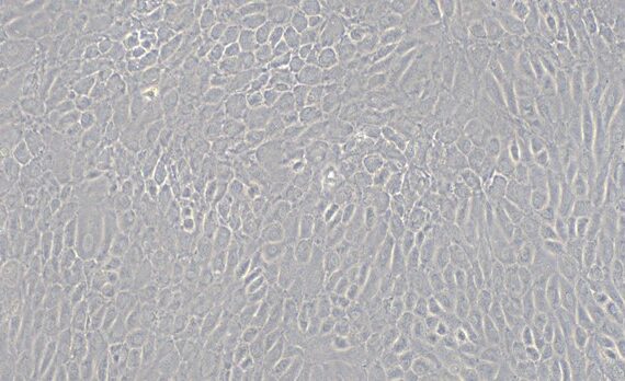 Primary Rat Nasal Mucosal Epithelial Cells (NMEC)