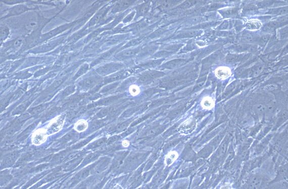 Primary Rabbit Choroid Plexus Fibroblasts (CPF)