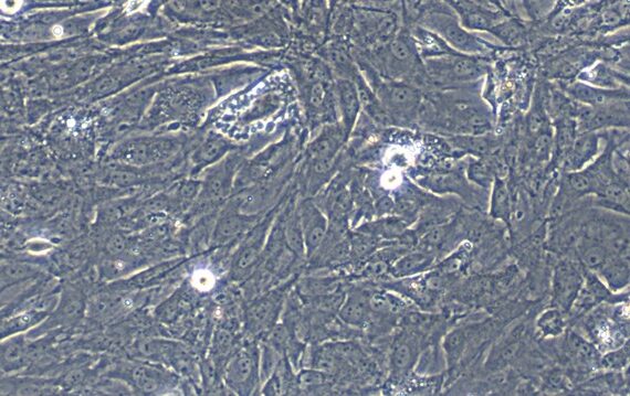 Primary Rabbit Retinal Muller Cells (RMCs)