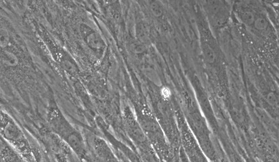 Primary Rabbit Splenic Fibroblasts (SF)
