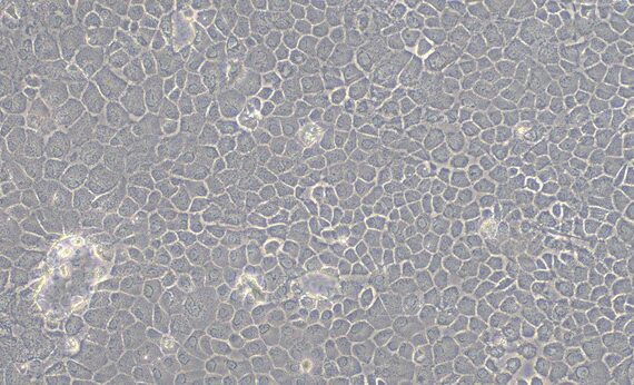 Primary Rat Gingival Epithelial Cells (GiEC)