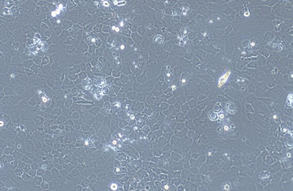 Primary Mouse Auricular Chondrocytes (ACC)