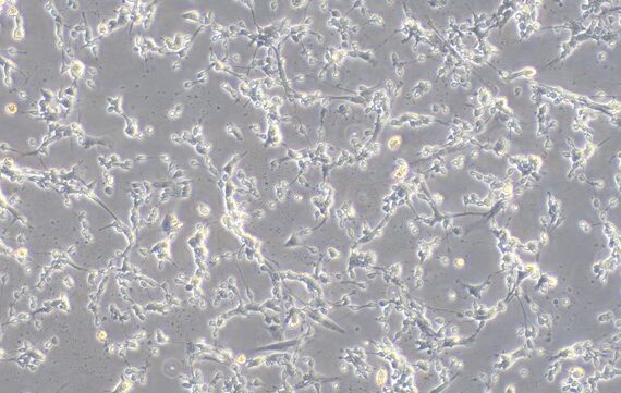 Primary Rat Olfactory Bulb Neuron Cells (OBNC)