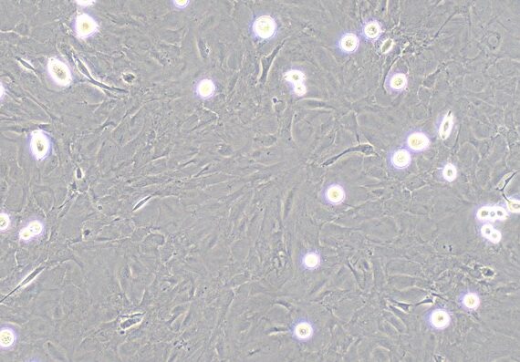 Primary Rat Nasal Mucosa Fibroblasts (NMF)