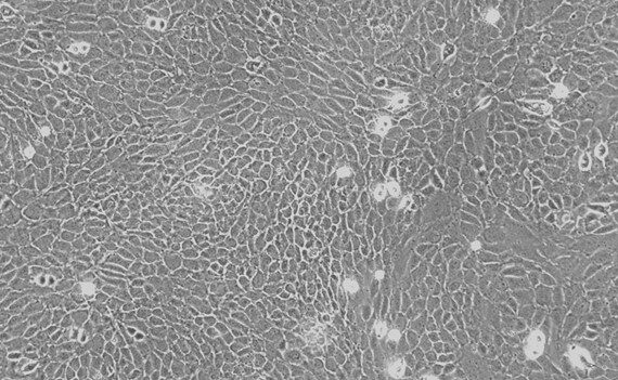Primary Rat Olfactory Epithelial Cells (OEC)