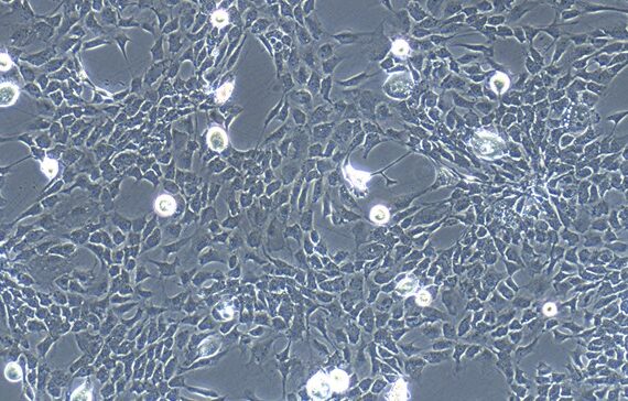 Primary Rat Adipose Microvascular Endothelial Cells (AMEC)
