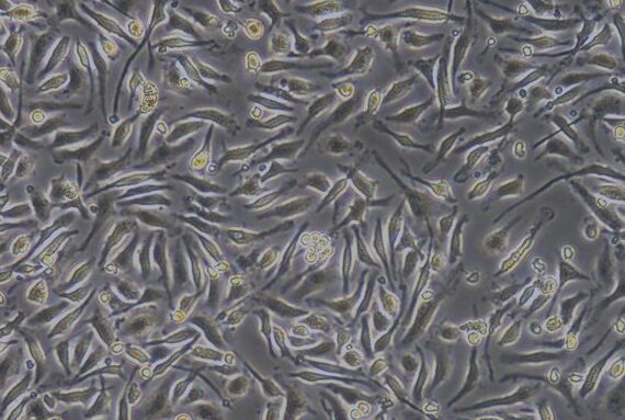 Primary Mouse Bone Marrow-Derived Macrophage Cells (BMDM)