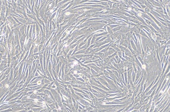 Primary Rabbit Carotid Artery Endothelial Cells (CAEC)