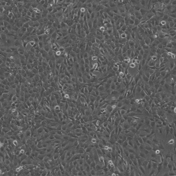 Primary Human Brain Microvascular Endothelial Cells (BMEC)