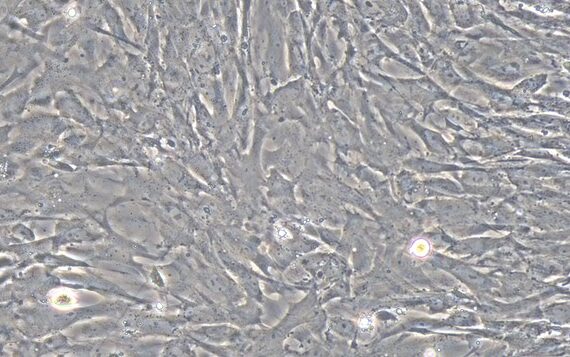 Primary Rat Uterine Smooth Muscle Cells (USMC)